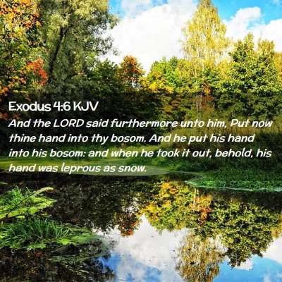 Exodus 4:6 KJV Free Bible Images