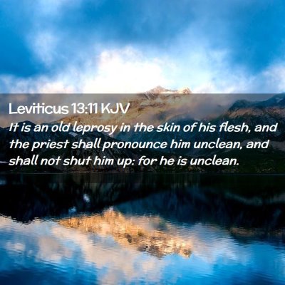 Leviticus 13:11 KJV Free Bible Images